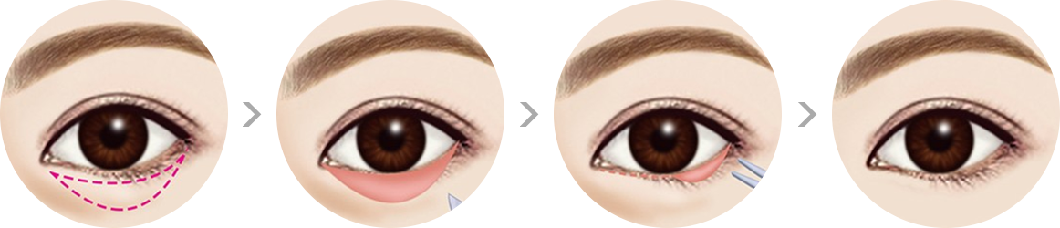 a1c72029b803a32461ab4fc34a60c633_1556525180_8698.png